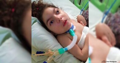Mãe pede ajuda para filha com microcefalia e desvio espinhal internada há um ano em Sobral