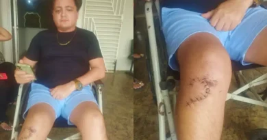 Músico de Ipu denuncia tentativa de homicídio após agressão