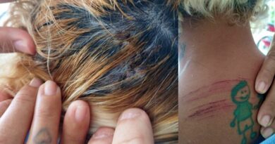 Mulher é agredida a pauladas, desferidas por vizinho no bairro Pereiros, em Ipu